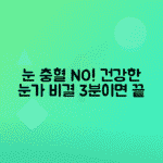 눈 가장자리 충혈 원인, 관리 방법 총정리